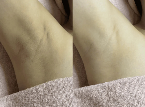 Cyperus Rotundus Regrowth Prevention