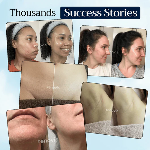 Cyperus Rotundus Regrowth Prevention